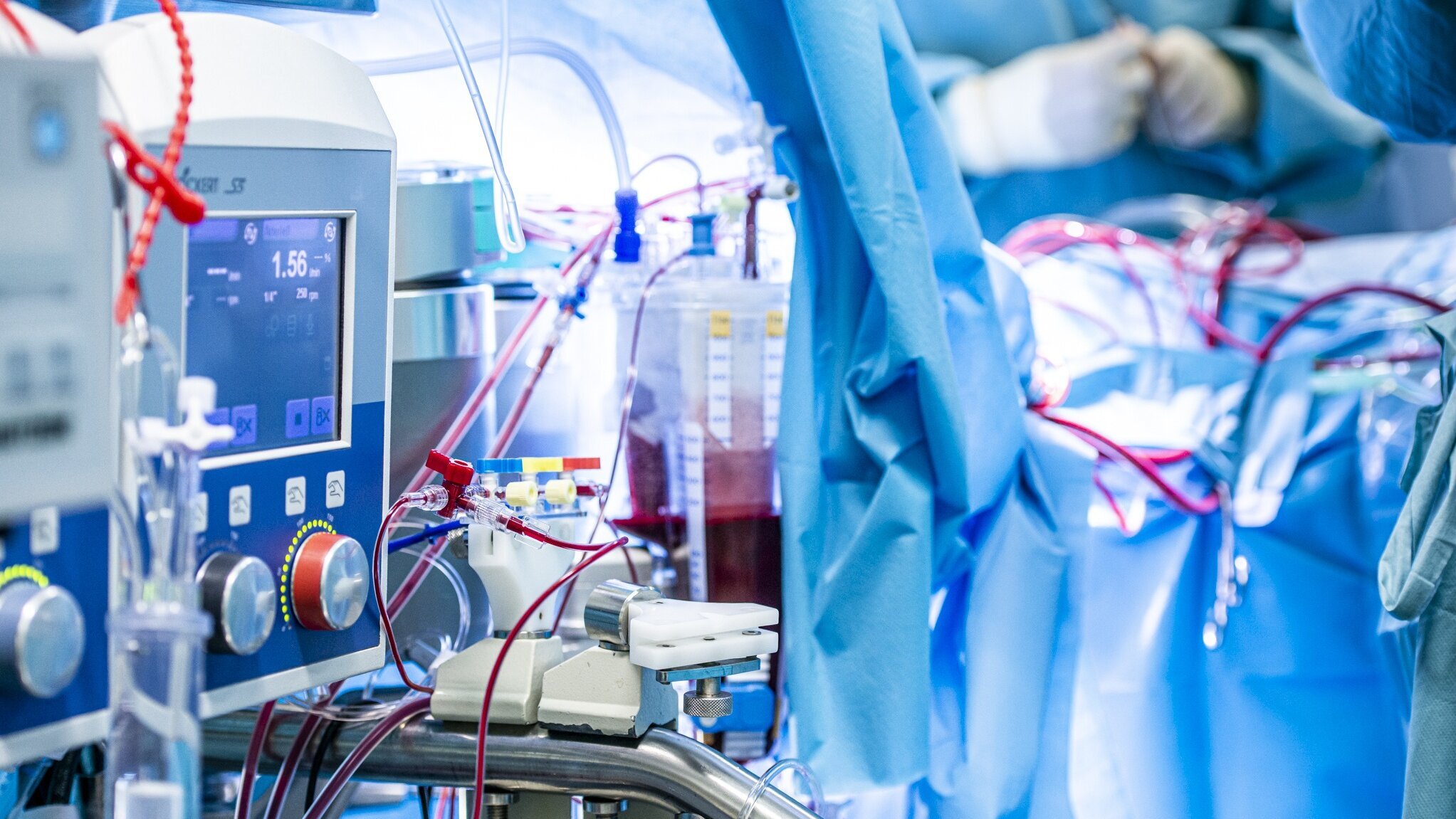 Ein chirurgisches Umfeld mit medizinischen Geräten und Schläuchen. Ein Monitor zeigt Werte an, während mehrere Schläuche mit einer roten Flüssigkeit verbunden sind. Im Hintergrund sind Personen in chirurgischer Kleidung zu sehen, die an dem Gerät arbeiten.