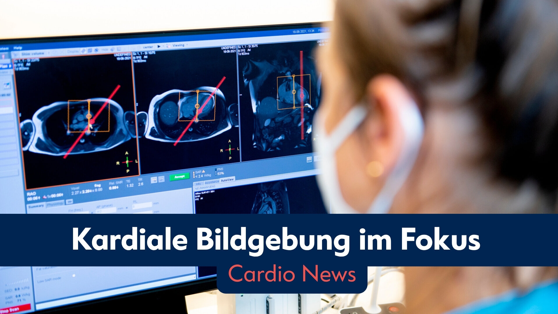 Eine Person betrachtet auf einem Computerbildschirm mehrere bildgebende Darstellungen des Herzens. Die Bilder sind markiert, um wichtige Bereiche hervorzuheben. Der Titel lautet „Kardiale Bildgebung im Fokus“ und darunter steht „Cardio News“.
