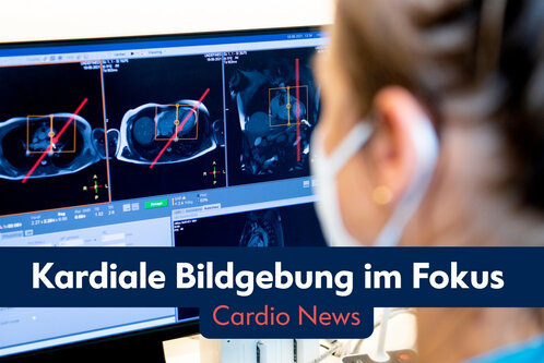 Eine Person betrachtet auf einem Computerbildschirm mehrere bildgebende Darstellungen des Herzens. Die Bilder sind markiert, um wichtige Bereiche hervorzuheben. Der Titel lautet „Kardiale Bildgebung im Fokus“ und darunter steht „Cardio News“.