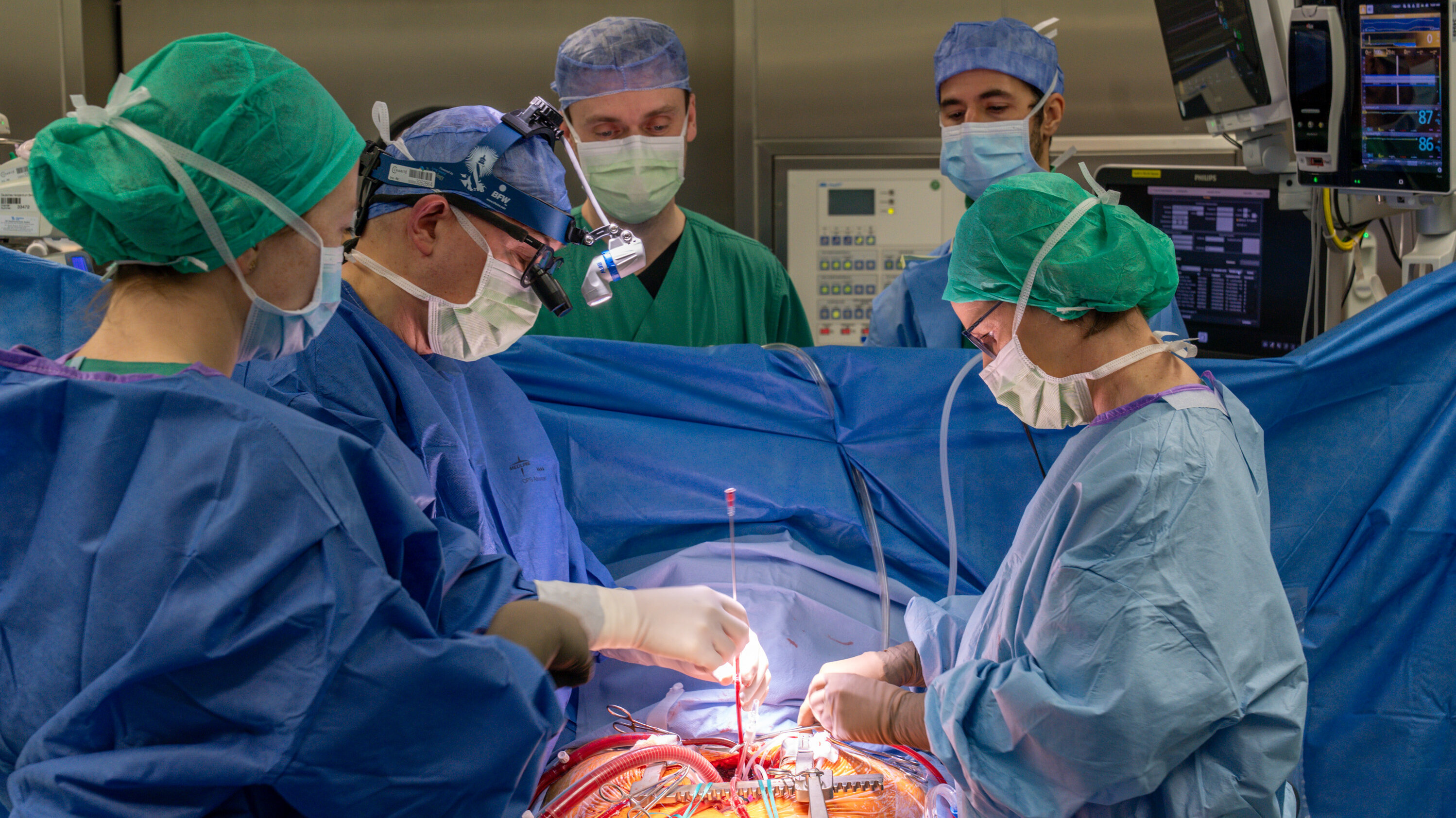 In einem Operationssaal sind mehrere Chirurgen und medizinisches Personal in blauer und grüner Sterilkleidung zu sehen. Sie führen eine komplexe Operation durch, während sie sich konzentriert um den Patienten kümmern, der auf dem Operationstisch liegt.