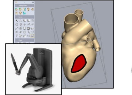 Das Bild zeigt ein 3D-Modell eines menschlichen Herzens, das in einem medizinischen Softwareprogramm dargestellt ist. Ein Teil des Herzens ist rot hervorgehoben. Neben dem Herzmodell befindet sich eine Grafik eines robotergestützten chirurgischen Instruments.