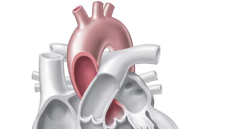 The aorta - function, diseases and treatments