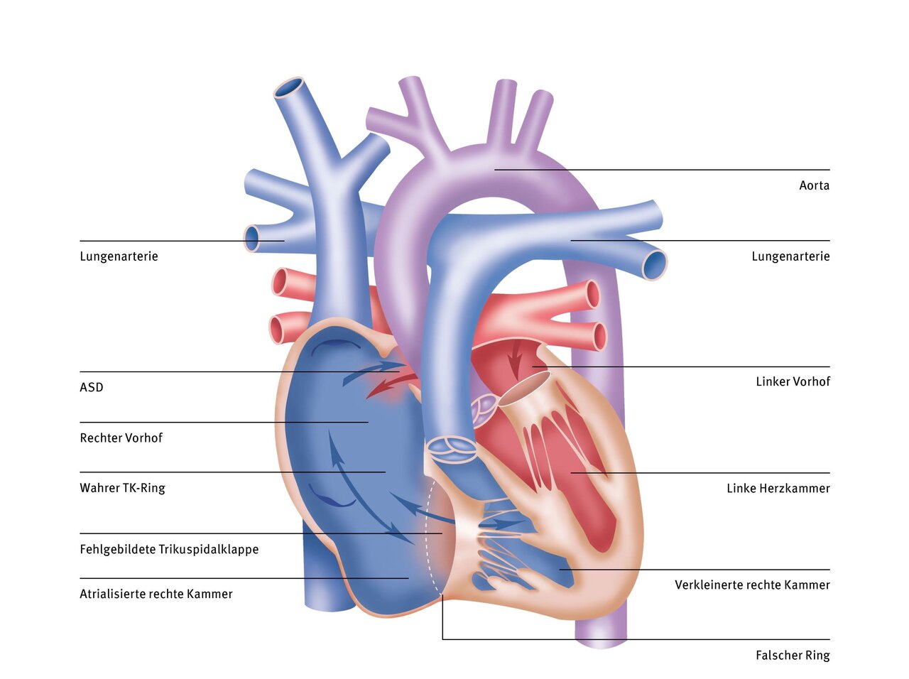 Diagramm des menschlichen Herzens mit beschrifteten Strukturen. Es zeigt die linke und rechte Kammer, die Vorhöfe, die Aorta sowie die Lungenarterie. Die Beschriftungen erläutern wichtige Teile des Herzens und deren Funktion im Blutkreislauf.