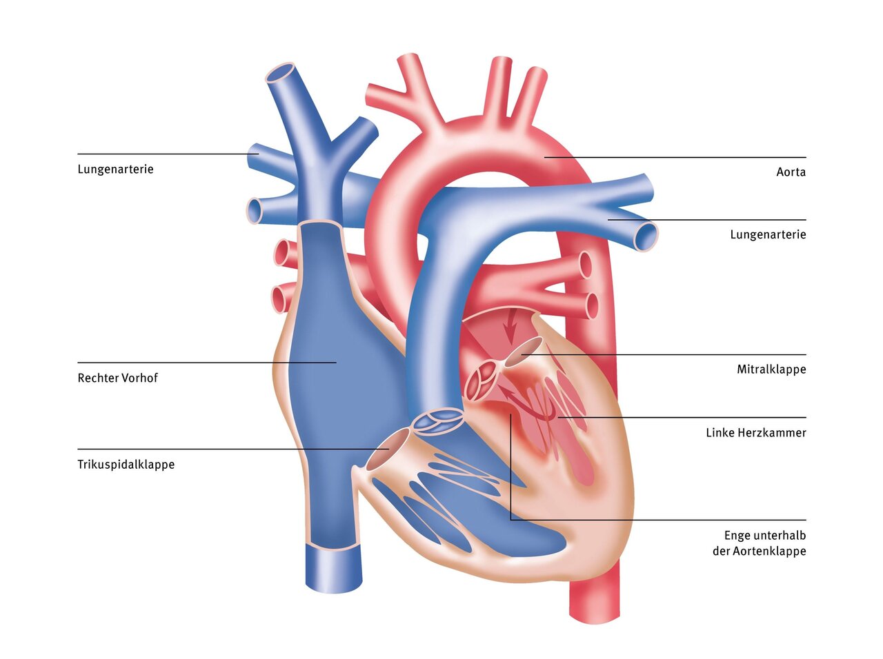 Eine schematische Darstellung des menschlichen Herzens, die verschiedene Komponenten wie die Lungenarterie, den rechten Vorhof, die Trikuspidalklappe, die Mitralklappe sowie die linke Herzkammer zeigt. Die Teile sind klar gekennzeichnet, um die Herzstruktur zu verdeutlichen.