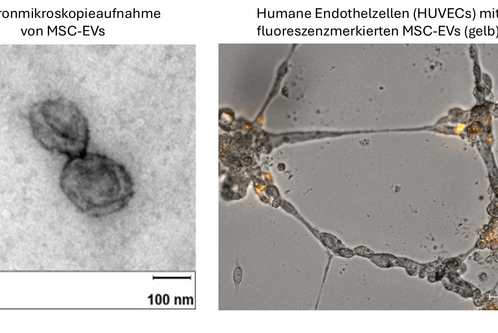 Die linke Seite zeigt eine Elektronenmikroskopaufnahme von mesenchymalen Stammzellen-Derivaten (MSC-EVs), die als ovalartige Strukturen erscheinen. Rechts sind humane Endothelzellen (HUVECs) zu sehen, die mit gelb fluoreszierenden MSC-EVs markiert sind, die in einem Netzwerk angeordnet sind.