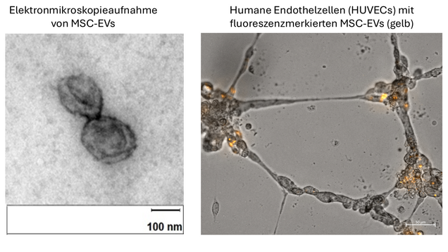 Die linke Seite zeigt eine Elektronenmikroskopaufnahme von mesenchymalen Stammzellen-Derivaten (MSC-EVs), die als ovalartige Strukturen erscheinen. Rechts sind humane Endothelzellen (HUVECs) zu sehen, die mit gelb fluoreszierenden MSC-EVs markiert sind, die in einem Netzwerk angeordnet sind.
