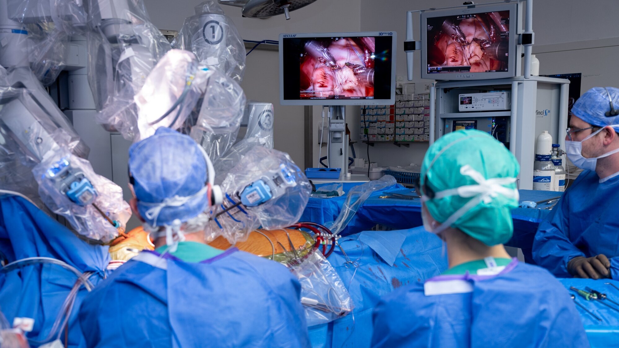 In einem Operationssaal arbeiten Chirurgen mit einem Robotersystem, um eine minimalinvasive Operation durchzuführen. An Bildschirmen werden während des Eingriffs Innereien angezeigt. Das Team trägt chirurgische Kleidung und Schutzmasken.