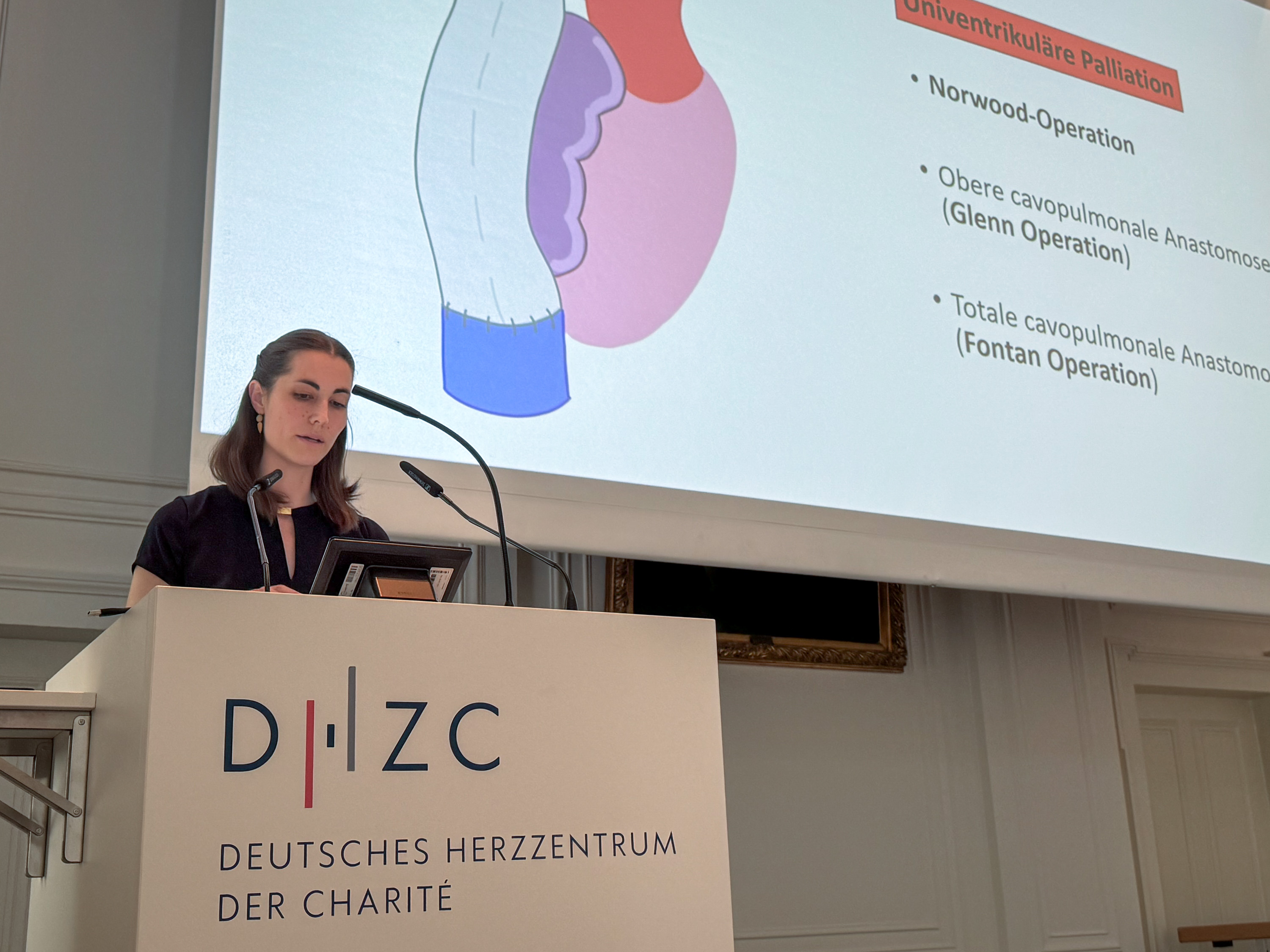 Eine Präsentatorin steht am Podium und spricht über univentrikuläre Palliation. Im Hintergrund sind Illustrationen von Herzoperationen, einschließlich Norwood-, Glenn- und Fontan-Operationen, zu sehen. An dem Podium befindet sich die Aufschrift des Deutschen Herzzentrums der Charité.