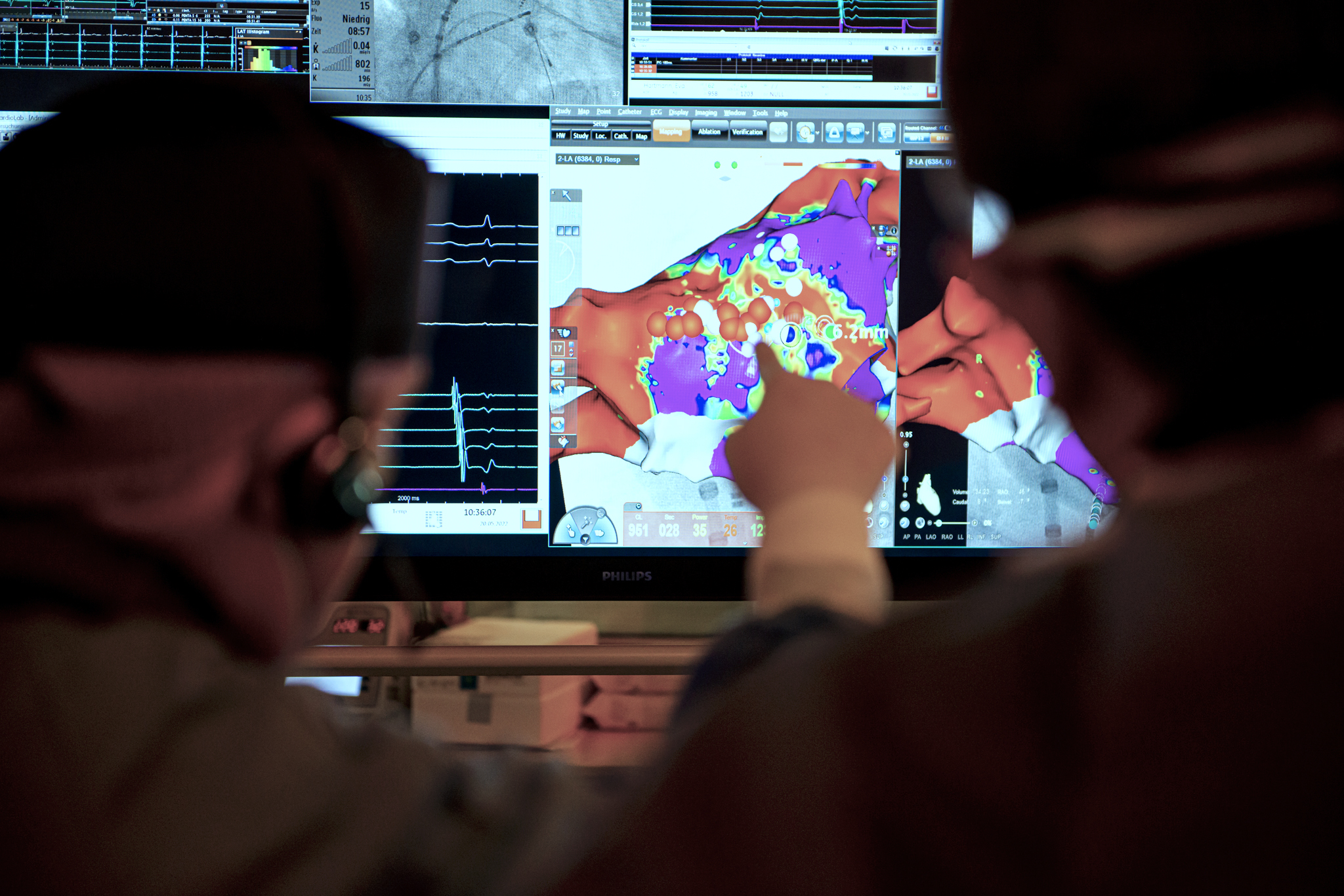 Zwei Personen in Kitteln betrachten einen großen Bildschirm mit farbigen Grafiken, die medizinische Daten darstellen. Eine Person zeigt mit dem Finger auf die grafischen Darstellungen. Die Umgebung deutet auf eine medizinische oder technische Anwendungsumgebung hin.